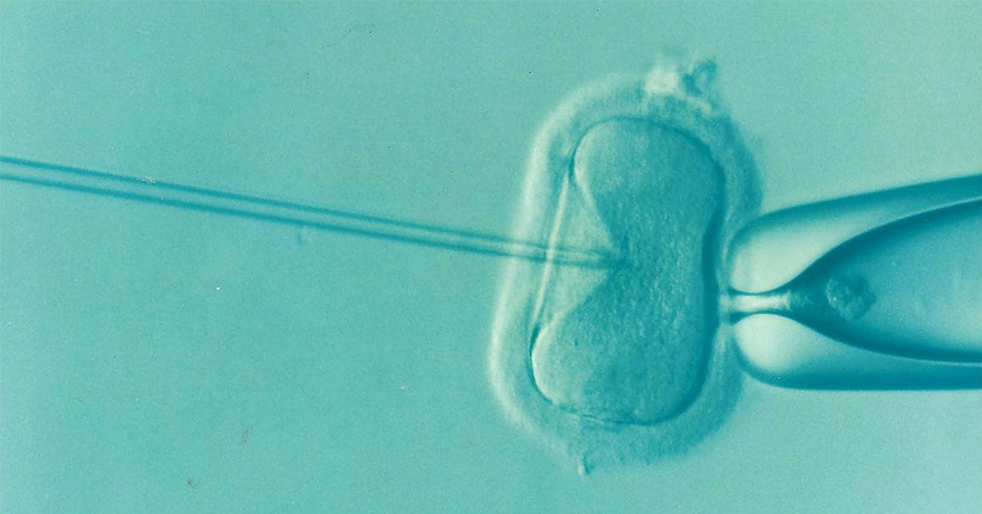 ivf illustration