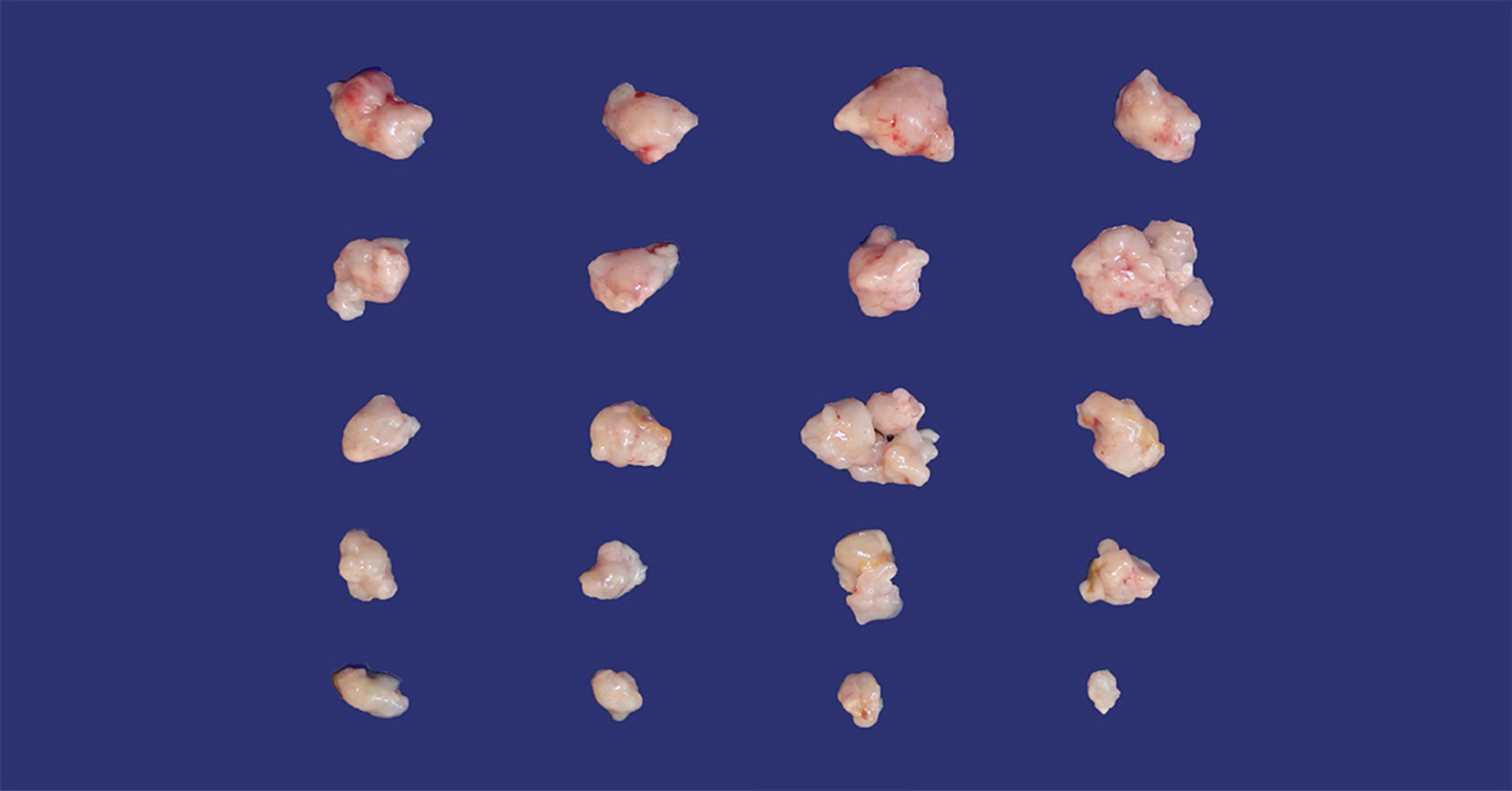 Mouse pancreatic tumors were significantly smaller after being treated with a combination of KRAS inhibitor MRTX1133 and ERBB inhibitor Afatinib (bottom row), compared to no treatment (top row) or being treated with Afatinib (second row) or MRTX1133 (third and fourth rows) alone.