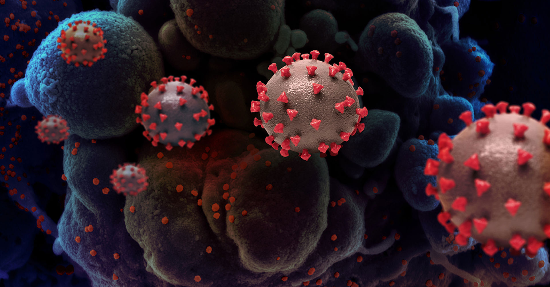Researchers found in a novel study that the transmission of SARS-CoV-2, a pathogenic virus that causes COVID-19, could be prevented using simple measures in the health care setting at UC San Diego Health. Photo credit: NIAID-RML